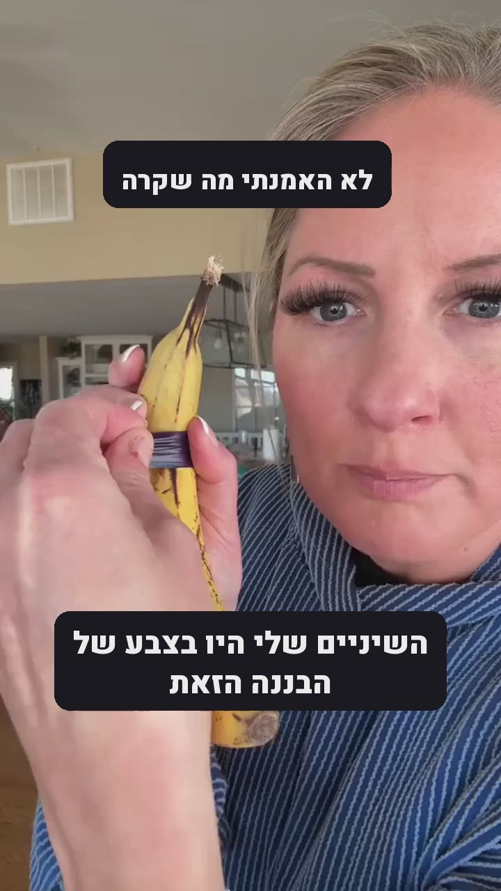 השיניים שלי היו בצבע של הבננה הזאת