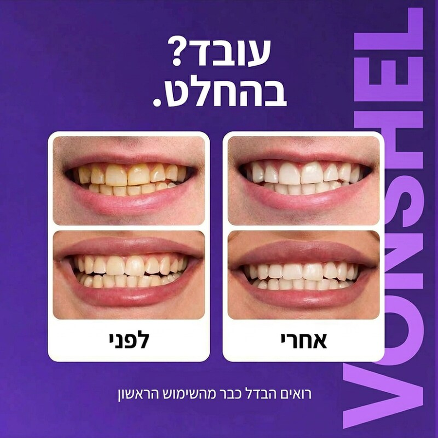 לפני ואחרי עם רצועות ההלבנה של Vonshel